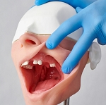 Surgical Manikin with Upper Edentulous and Lower Atrophic Mandible